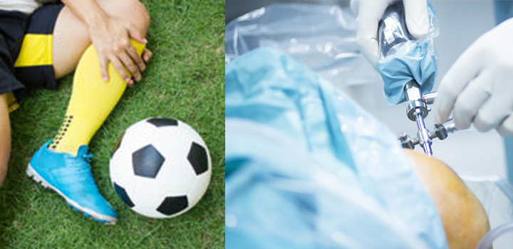 Arthroscopy And Sports Injuries | Vedant Hospital